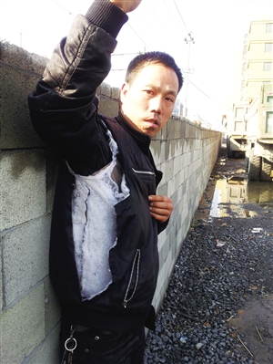 Lian-Di Chen show his torn jacket to the reporter